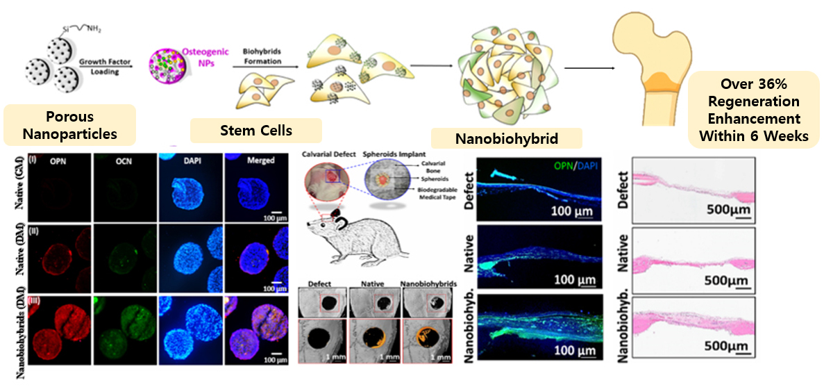 Next-Generation Nanoparticle–Stem Cell Hybrids Open a New Horizon in Bone Regeneration 이미지 1 - 본문에 자세한설명을 제공합니다.